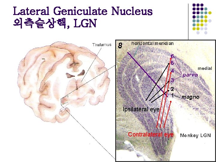 Lateral Geniculate Nucleus 외측슬상핵, LGN Ipsilateral eye Contralateral eye 
