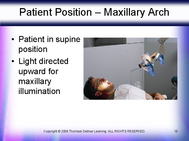 Patient Position – Maxillary Arch • Patient in supine position • Light directed upward