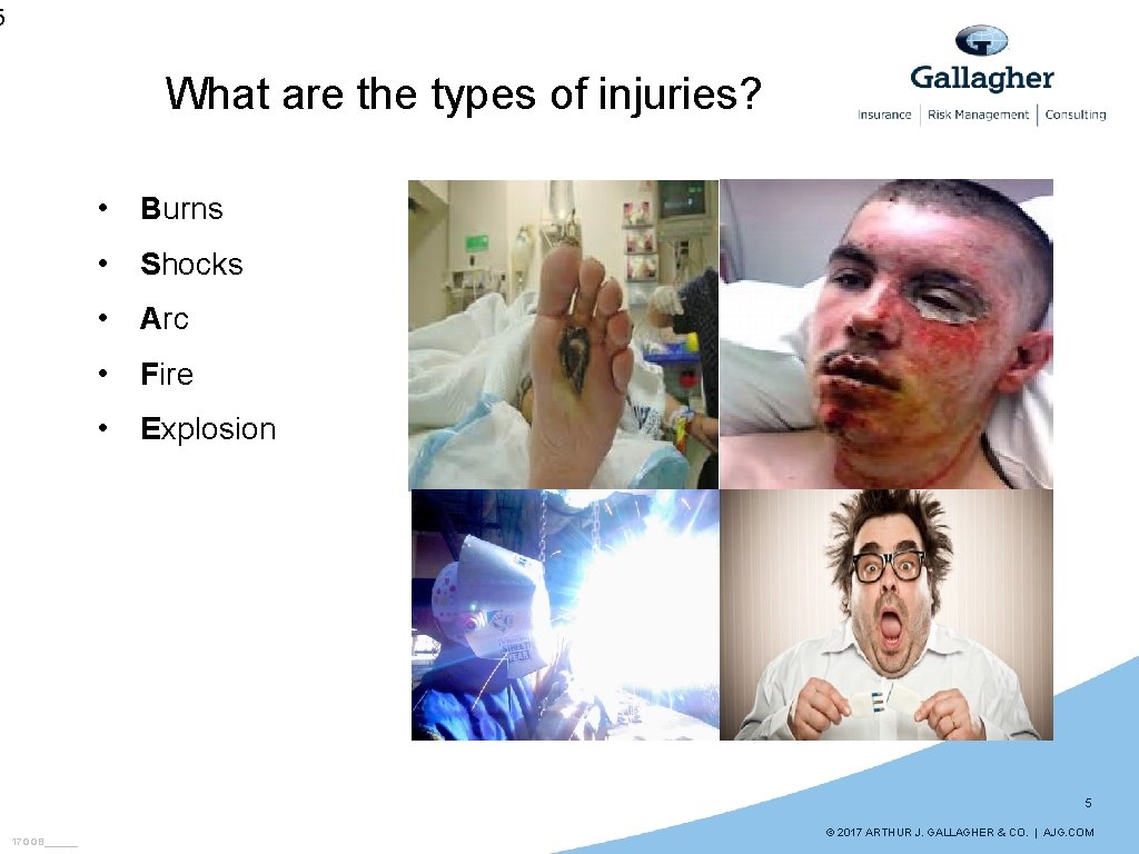 5 What are the types of injuries? • Burns • Shocks • Arc •