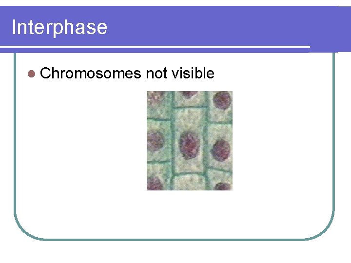 Interphase l Chromosomes not visible 