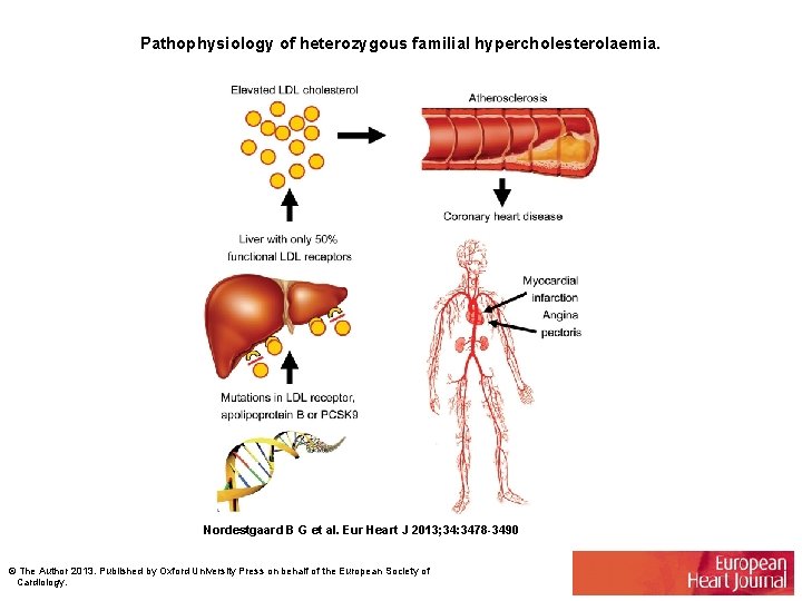 Pathophysiology of heterozygous familial hypercholesterolaemia. Nordestgaard B G et al. Eur Heart J 2013;