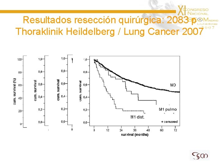 Resultados resección quirúrgica: 2083 p Thoraklinik Heildelberg / Lung Cancer 2007 