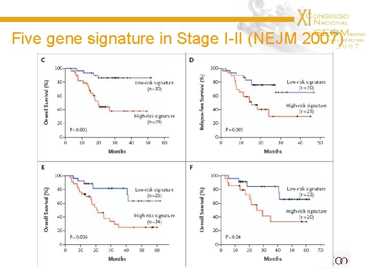 Five gene signature in Stage I-II (NEJM 2007) 