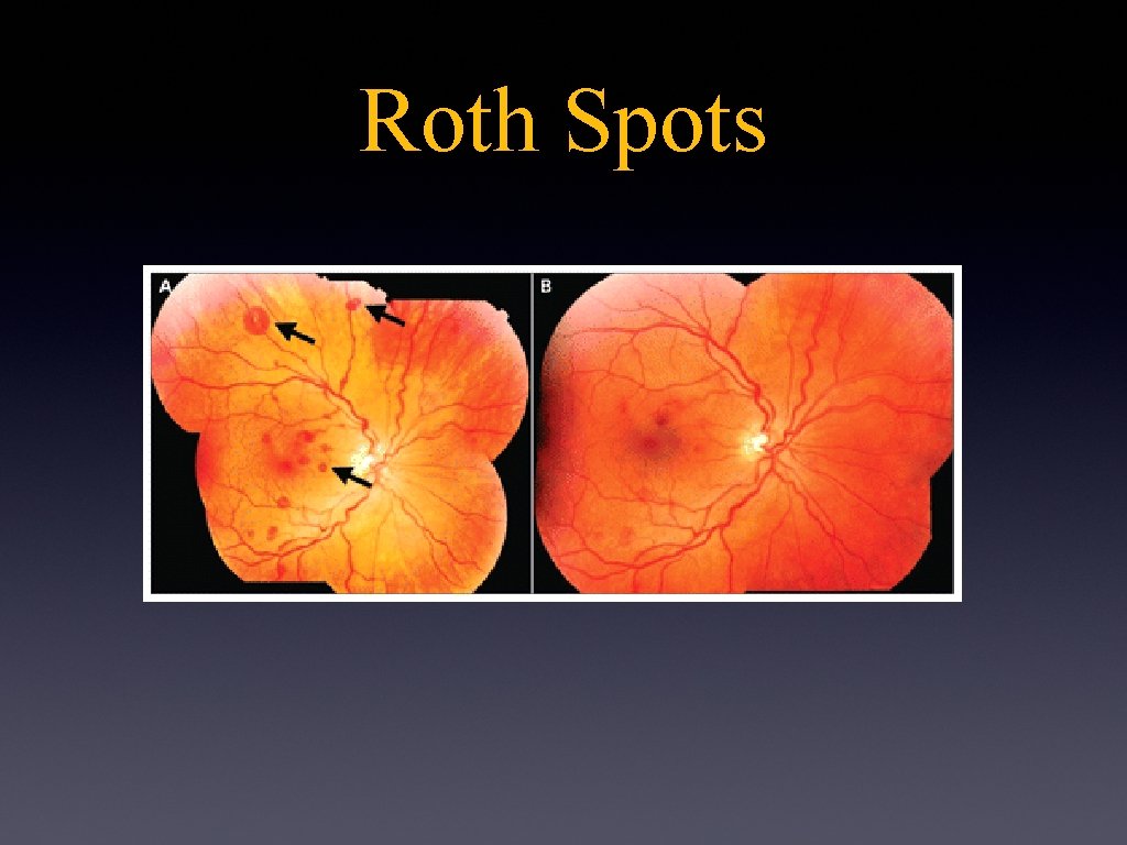 Roth Spots 