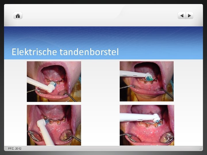 Elektrische tandenborstel PPZ, 2012 