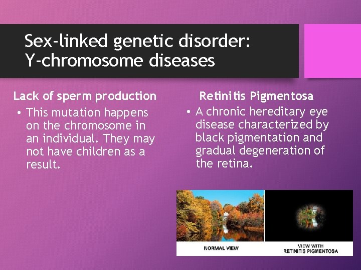 Sex-linked genetic disorder: Y-chromosome diseases Lack of sperm production • This mutation happens on