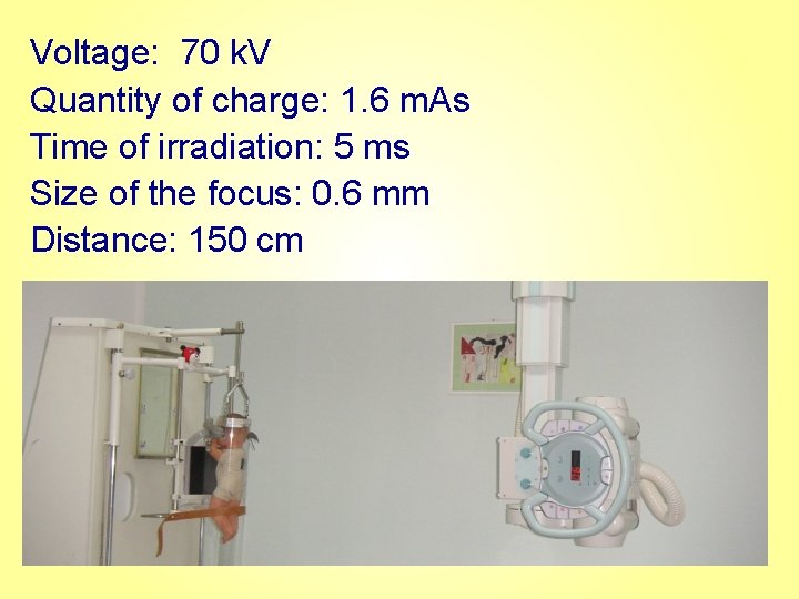 Voltage: 70 k. V Quantity of charge: 1. 6 m. As Time of irradiation: