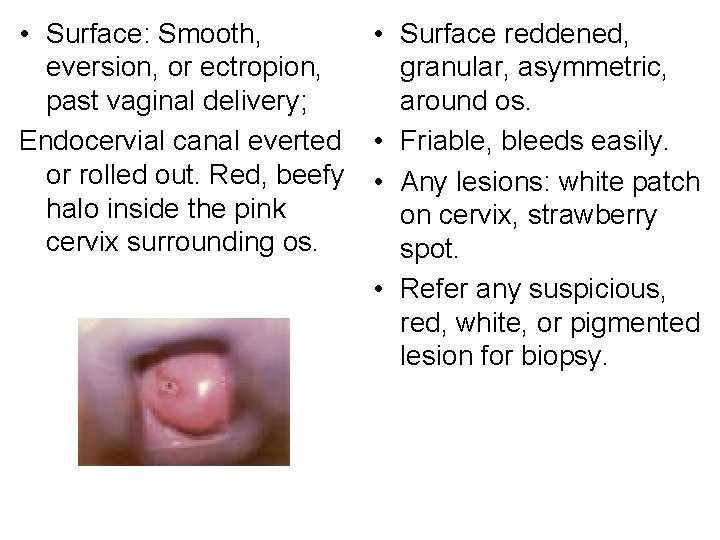  • Surface: Smooth, • Surface reddened, eversion, or ectropion, granular, asymmetric, past vaginal