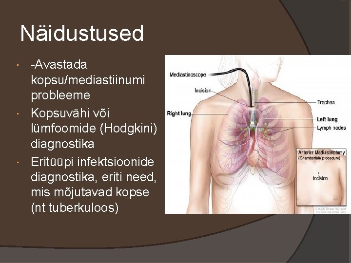 Näidustused -Avastada kopsu/mediastiinumi probleeme Kopsuvähi või lümfoomide (Hodgkini) diagnostika Eritüüpi infektsioonide diagnostika, eriti need,