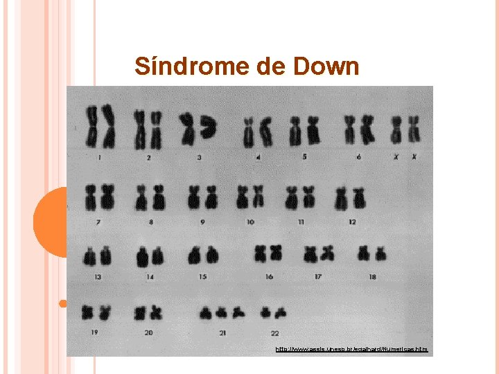 Síndrome de Down http: //www. assis. unesp. br/egalhard/Numericas. htm 