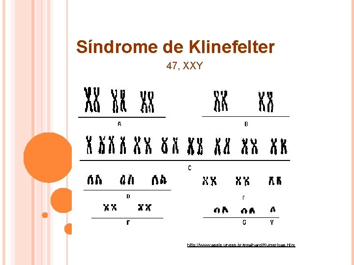Síndrome de Klinefelter 47, XXY http: //www. assis. unesp. br/egalhard/Numericas. htm 