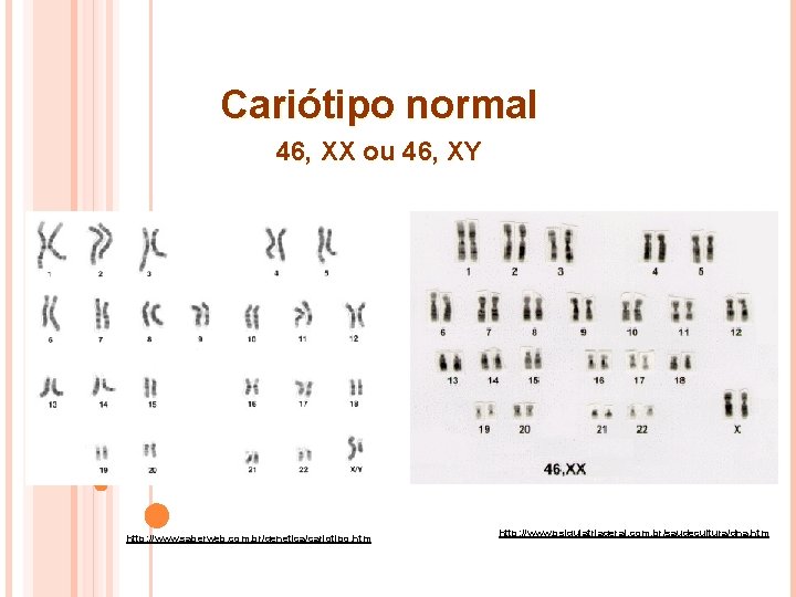 Cariótipo normal 46, XX ou 46, XY Elaboração Prof. Viviane Ferreira http: //www. saberweb.