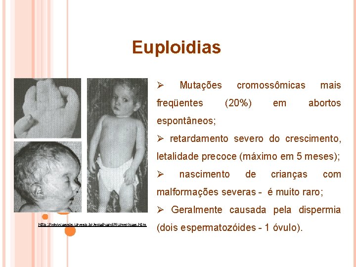 Euploidias Ø Mutações freqüentes cromossômicas (20%) em mais abortos espontâneos; Ø retardamento severo do