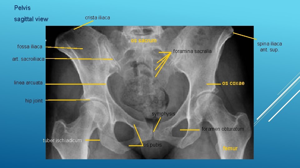 Pelvis sagittal view crista iliaca os sacrum fossa iliaca spina iliaca ant. sup. foramina