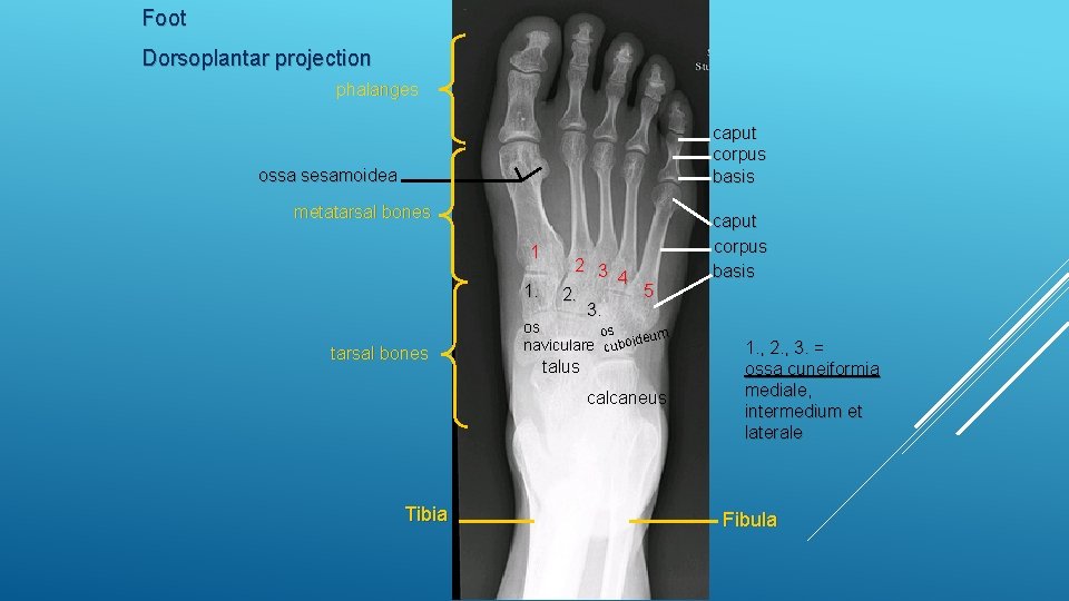 Foot Dorsoplantar projection phalanges caput corpus basis ossa sesamoidea metatarsal bones 1 1. tarsal