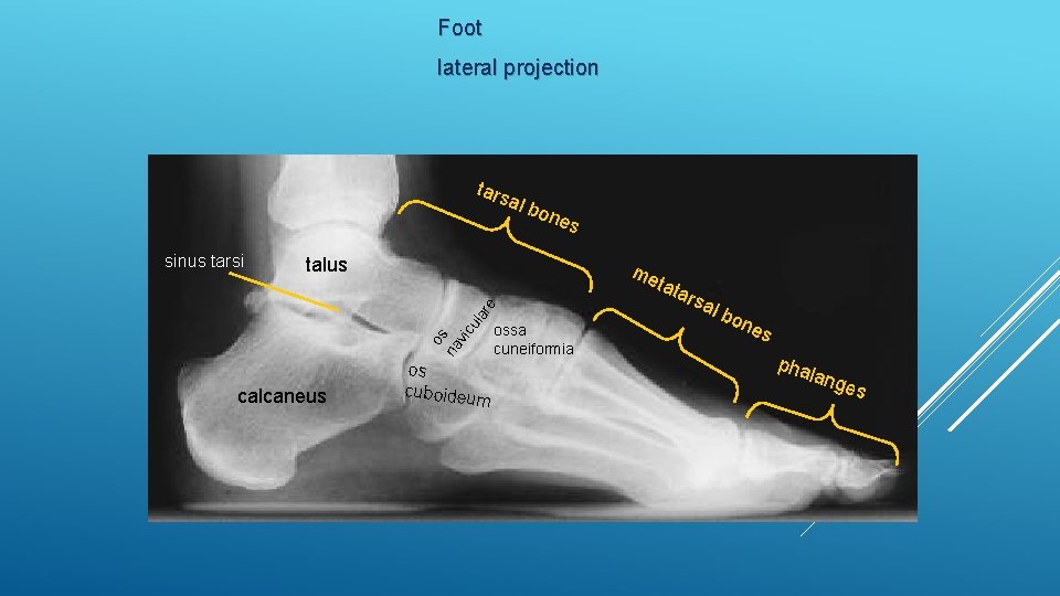 Foot lateral projection tars al b one s talus os na vic ula re