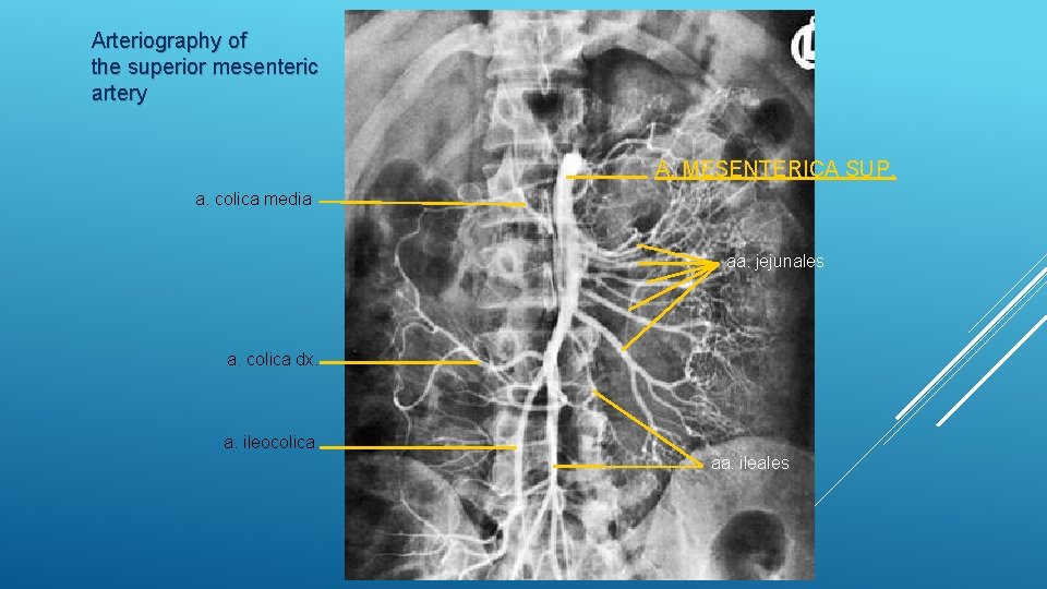 Arteriography of the superior mesenteric artery A. MESENTERICA SUP. a. colica media aa. jejunales