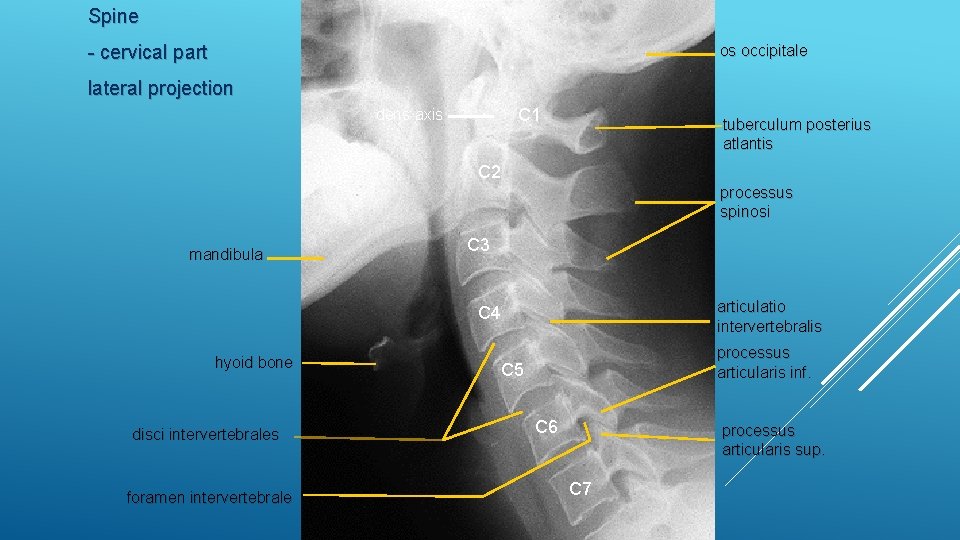 Spine - cervical part os occipitale lateral projection C 1 dens axis tuberculum posterius
