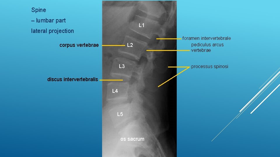 Spine – lumbar part L 1 lateral projection corpus vertebrae L 2 L 3