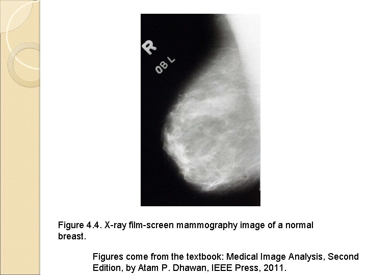 Figure 4. 4. X-ray film-screen mammography image of a normal breast. Figures come from