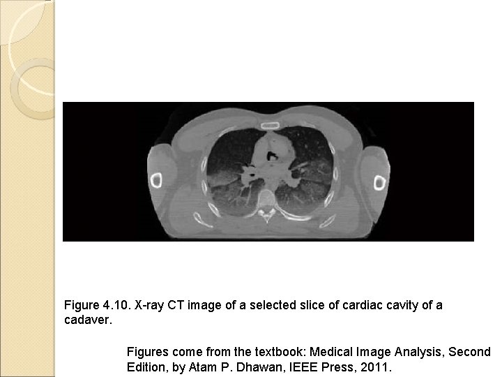 Figure 4. 10. X-ray CT image of a selected slice of cardiac cavity of