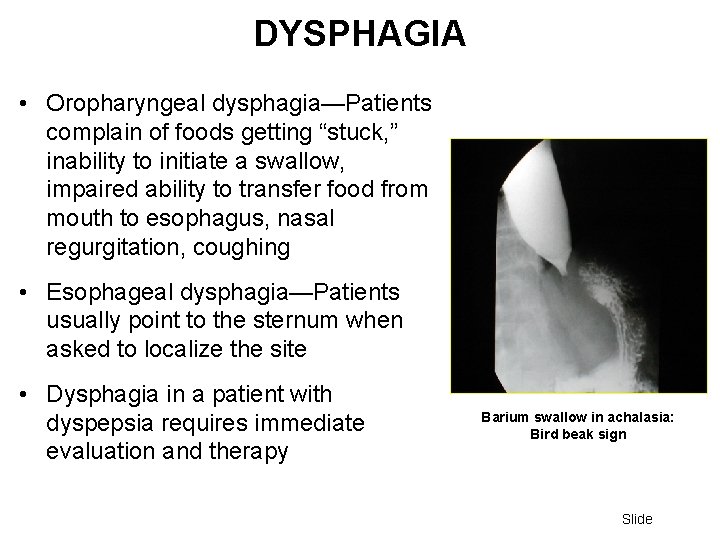 DYSPHAGIA • Oropharyngeal dysphagia—Patients complain of foods getting “stuck, ” inability to initiate a