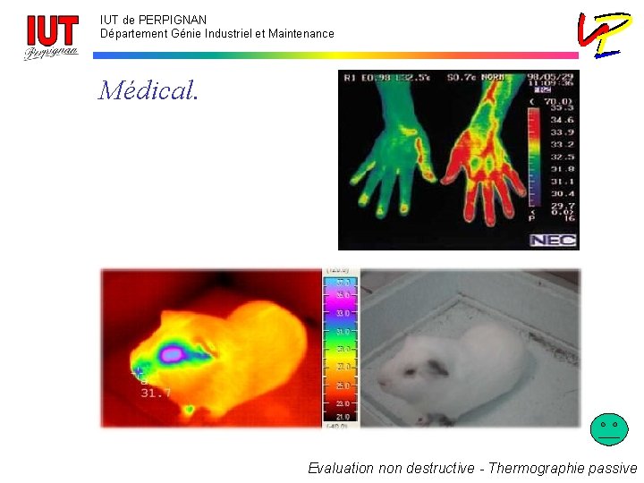 IUT de PERPIGNAN Département Génie Industriel et Maintenance Médical. Evaluation non destructive - Thermographie