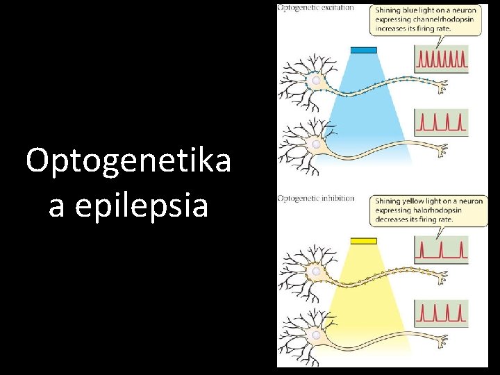 Optogenetika a epilepsia 