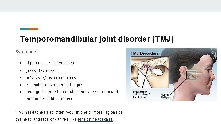 Temporomandibular joint disorder (TMJ) Symptoms: ● tight facial or jaw muscles ● jaw or