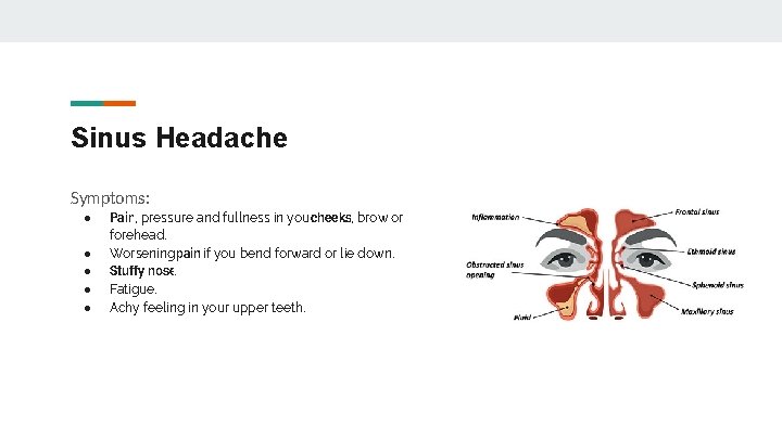 Sinus Headache Symptoms: ● ● ● Pain, pressure and fullness in yourcheeks, brow or