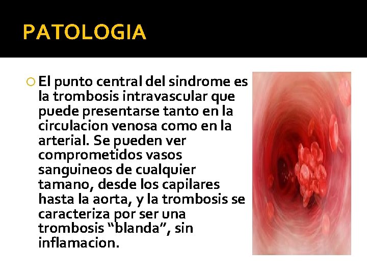 PATOLOGIA El punto central del sindrome es la trombosis intravascular que puede presentarse tanto PATOLOGIA El punto central del sindrome es la trombosis intravascular que puede presentarse tanto
