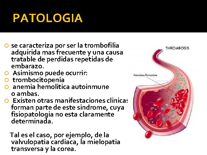 PATOLOGIA se caracteriza por ser la trombofilia adquirida mas frecuente y una causa tratable