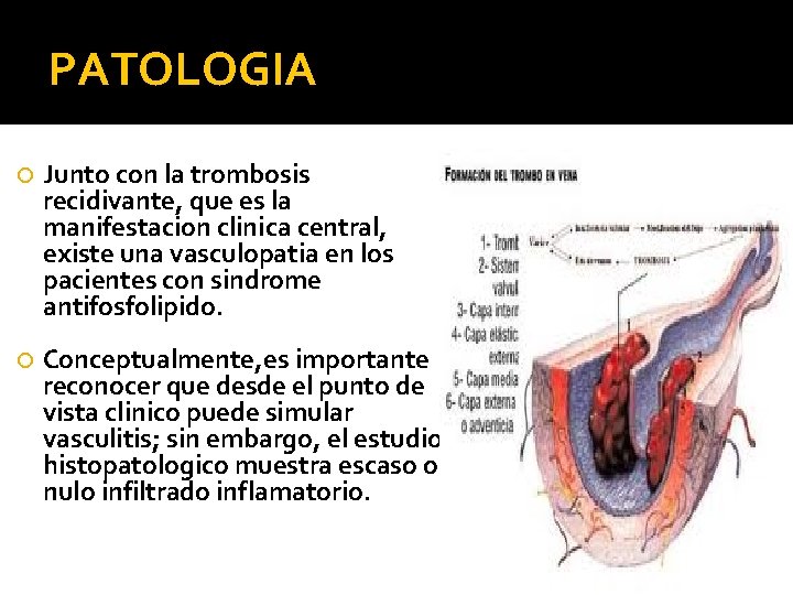 PATOLOGIA Junto con la trombosis recidivante, que es la manifestacion clinica central, existe una