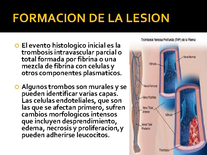 FORMACION DE LA LESION El evento histologico inicial es la trombosis intravascular parcial o