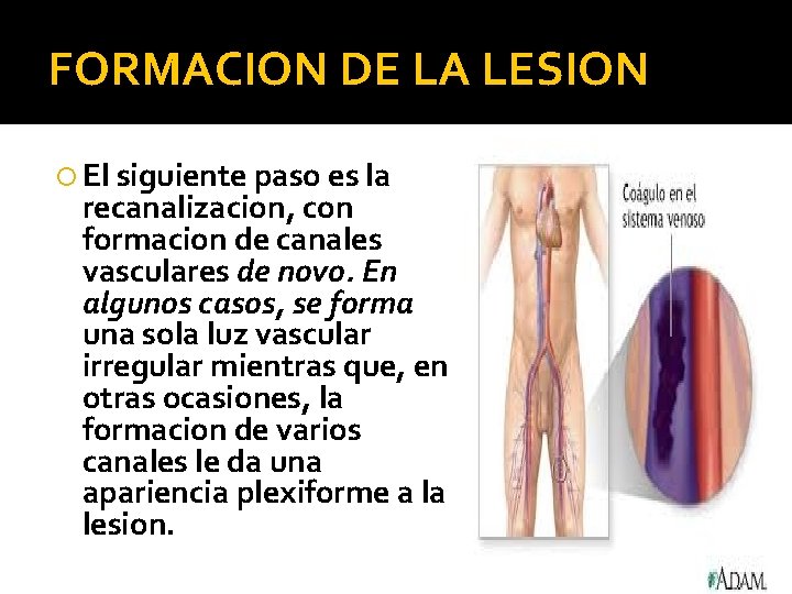 FORMACION DE LA LESION El siguiente paso es la recanalizacion, con formacion de canales