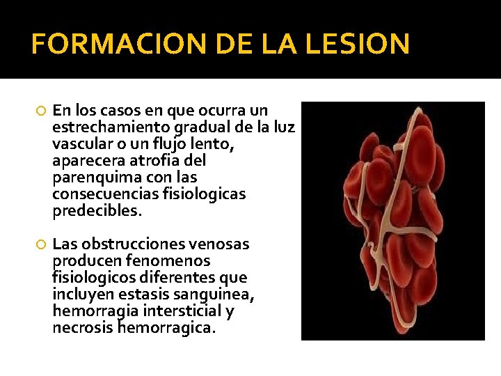 FORMACION DE LA LESION En los casos en que ocurra un estrechamiento gradual de