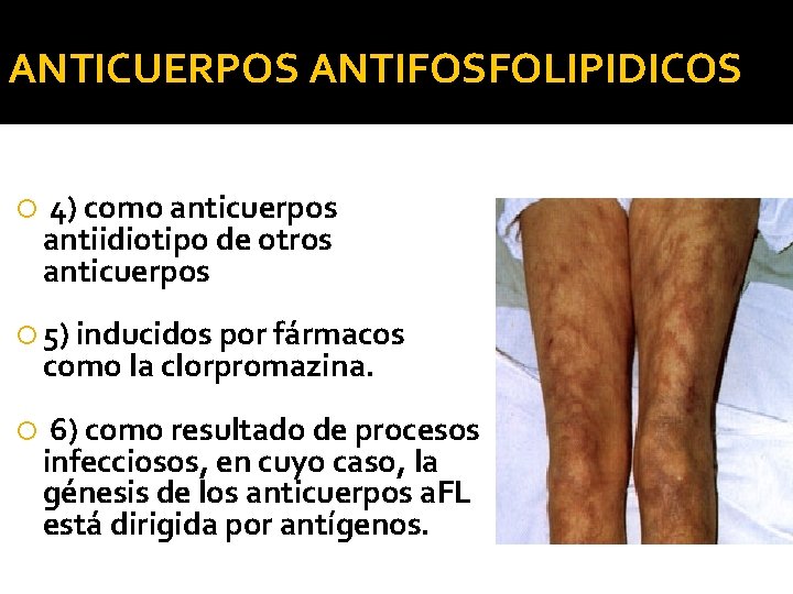 ANTICUERPOS ANTIFOSFOLIPIDICOS 4) como anticuerpos antiidiotipo de otros anticuerpos 5) inducidos por fármacos como