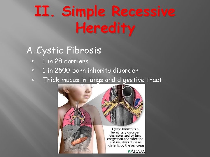 II. Simple Recessive Heredity A. Cystic Fibrosis 1 in 28 carriers 1 in 2500