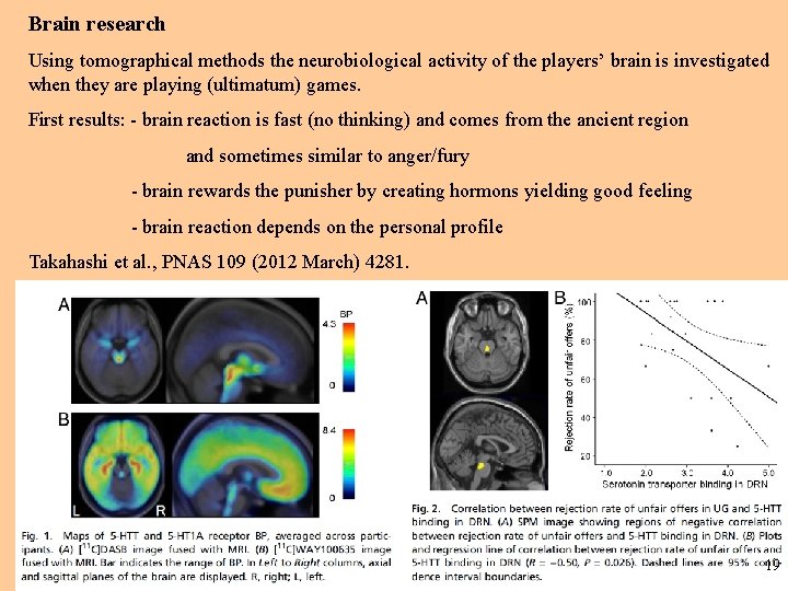 Brain research Using tomographical methods the neurobiological activity of the players’ brain is investigated Brain research Using tomographical methods the neurobiological activity of the players’ brain is investigated