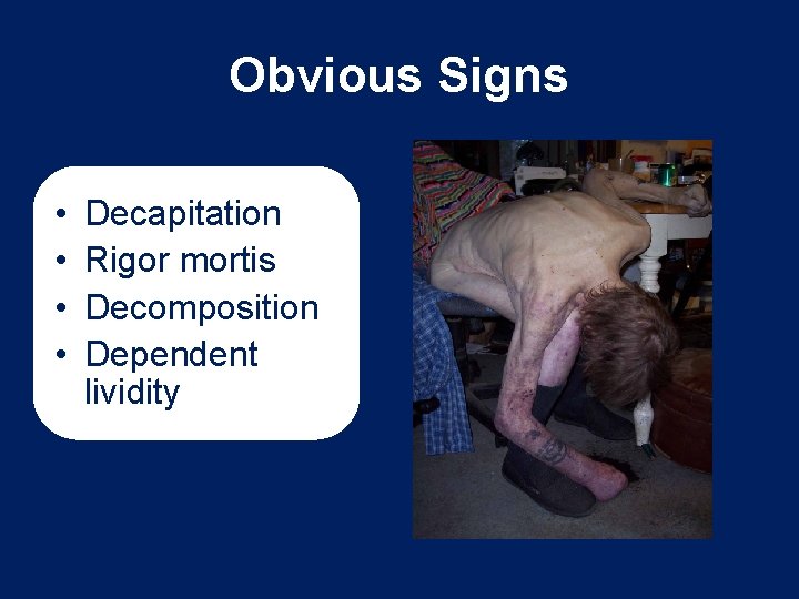 Obvious Signs • • Decapitation Rigor mortis Decomposition Dependent lividity 