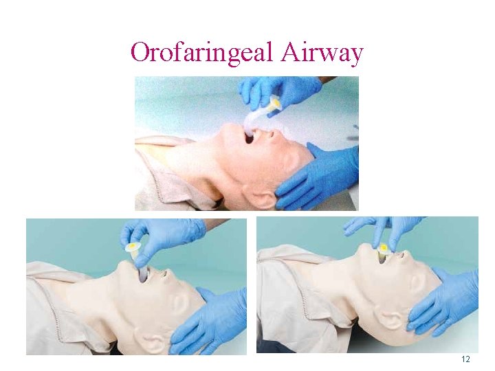 Orofaringeal Airway 12 