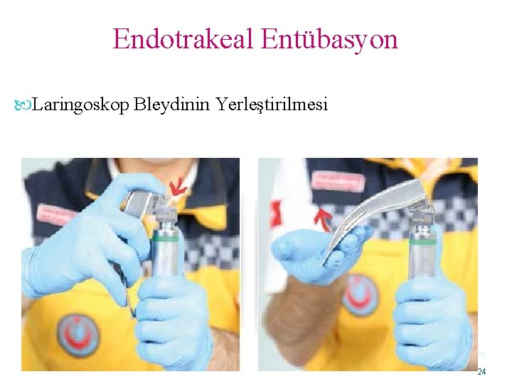 Endotrakeal Entübasyon Laringoskop Bleydinin Yerleştirilmesi 24 24 