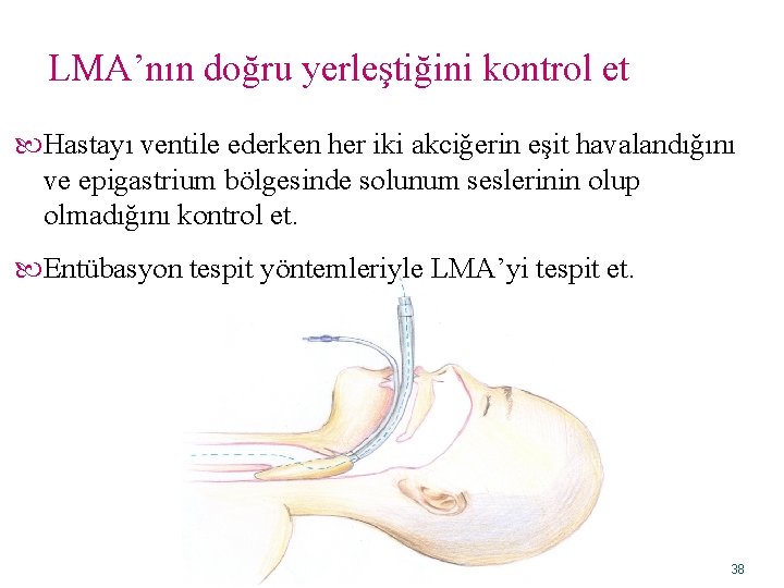 LMA’nın doğru yerleştiğini kontrol et Hastayı ventile ederken her iki akciğerin eşit havalandığını ve