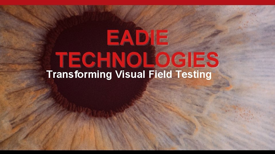 EADIE TECHNOLOGIES Transforming Visual Field Testing 
