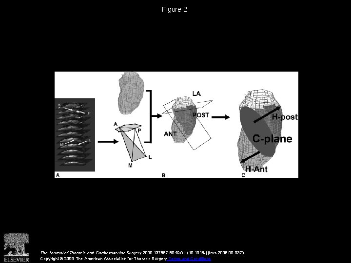 Figure 2 The Journal of Thoracic and Cardiovascular Surgery 2009 137887 -894 DOI: (10.