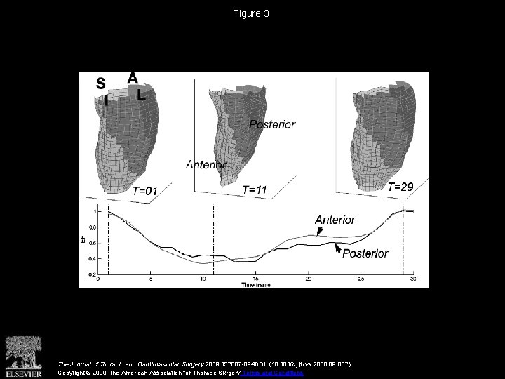 Figure 3 The Journal of Thoracic and Cardiovascular Surgery 2009 137887 -894 DOI: (10.