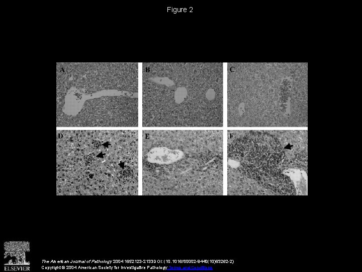 Figure 2 The American Journal of Pathology 2004 1652123 -2133 DOI: (10. 1016/S 0002