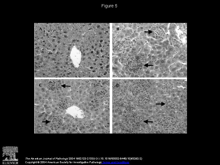 Figure 5 The American Journal of Pathology 2004 1652123 -2133 DOI: (10. 1016/S 0002