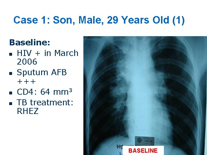 Case 1: Son, Male, 29 Years Old (1) Baseline: n HIV + in March