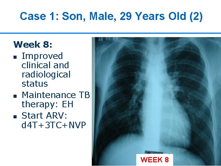 Case 1: Son, Male, 29 Years Old (2) Week 8: n Improved clinical and